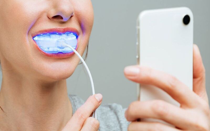 Sử dụng sản phẩm tẩy trắng răng thương mại