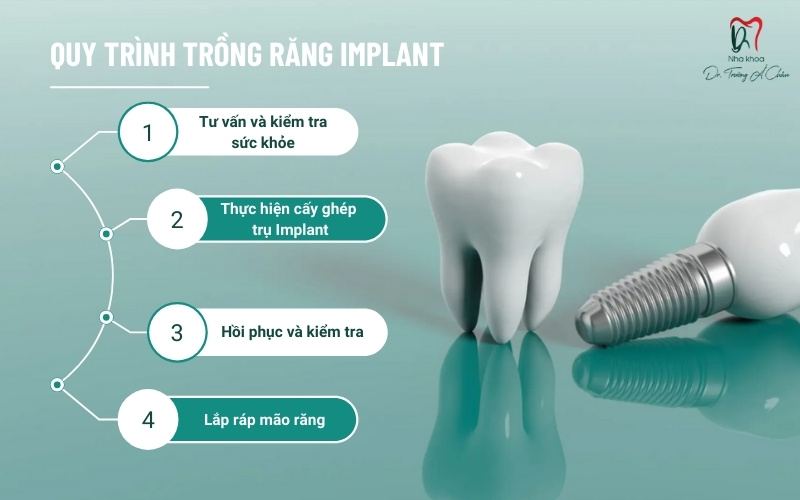Quy trình trồng răng Implant