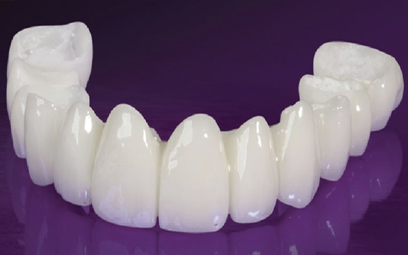 Răng sứ zirconia