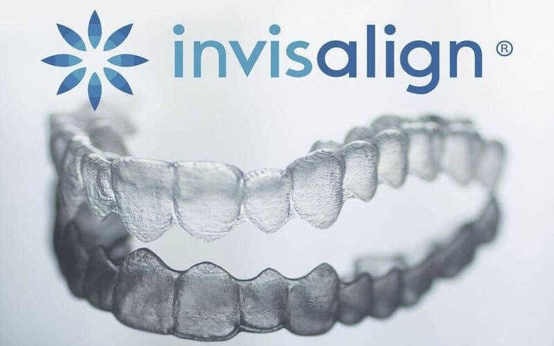 Ưu điểm của niềng răng trong suốt Invisalign 