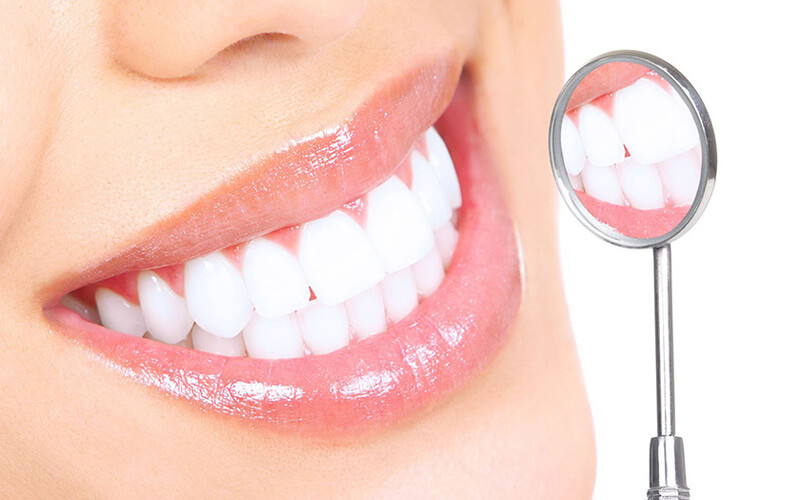 Lợi ích bọc răng sứ