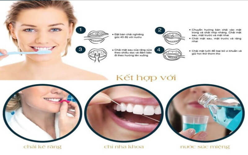 Cách chăm sóc cầu răng sứ