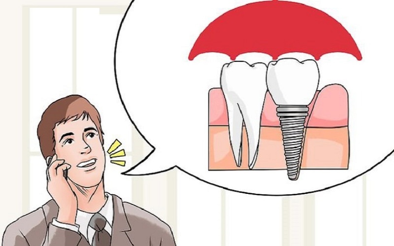 Có nên trồng răng implant không