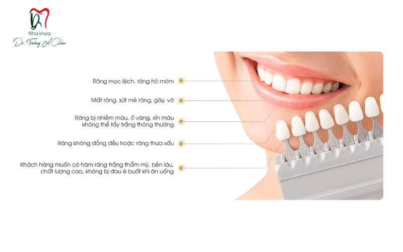 Lợi ích của răng sứ venus