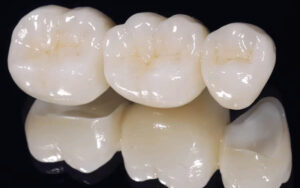 Răng sứ zirconia