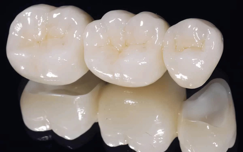 Răng sứ zirconia