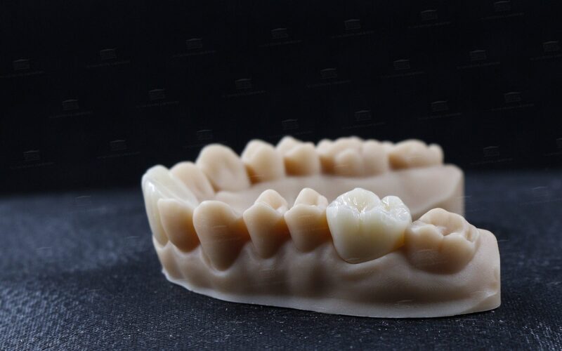 Răng sứ zirconia